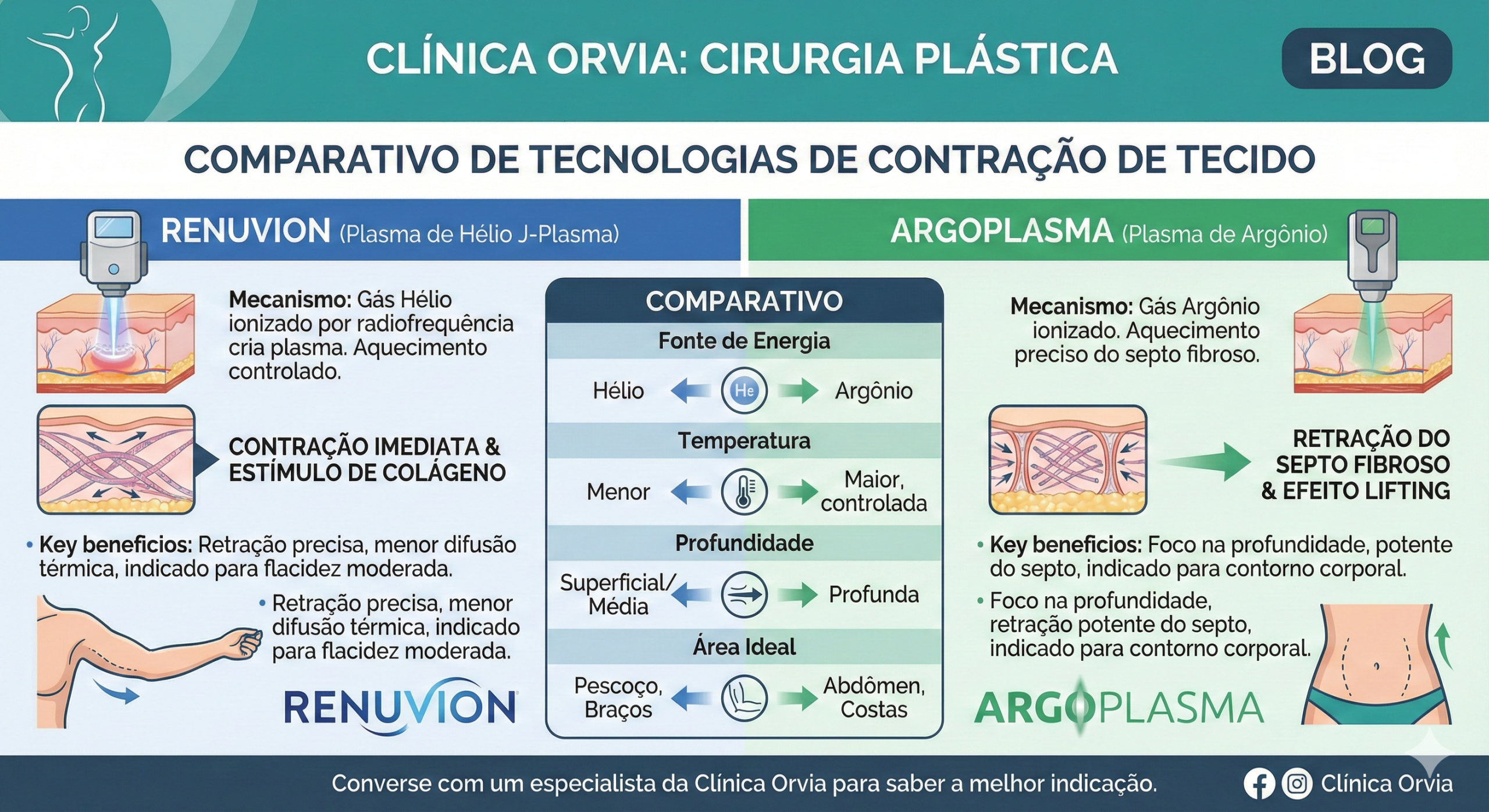 Tabela comparativa e ponteiras dos aparelhos cirúrgicos na análise de Renuvion vs Argoplasma para retração de pele.