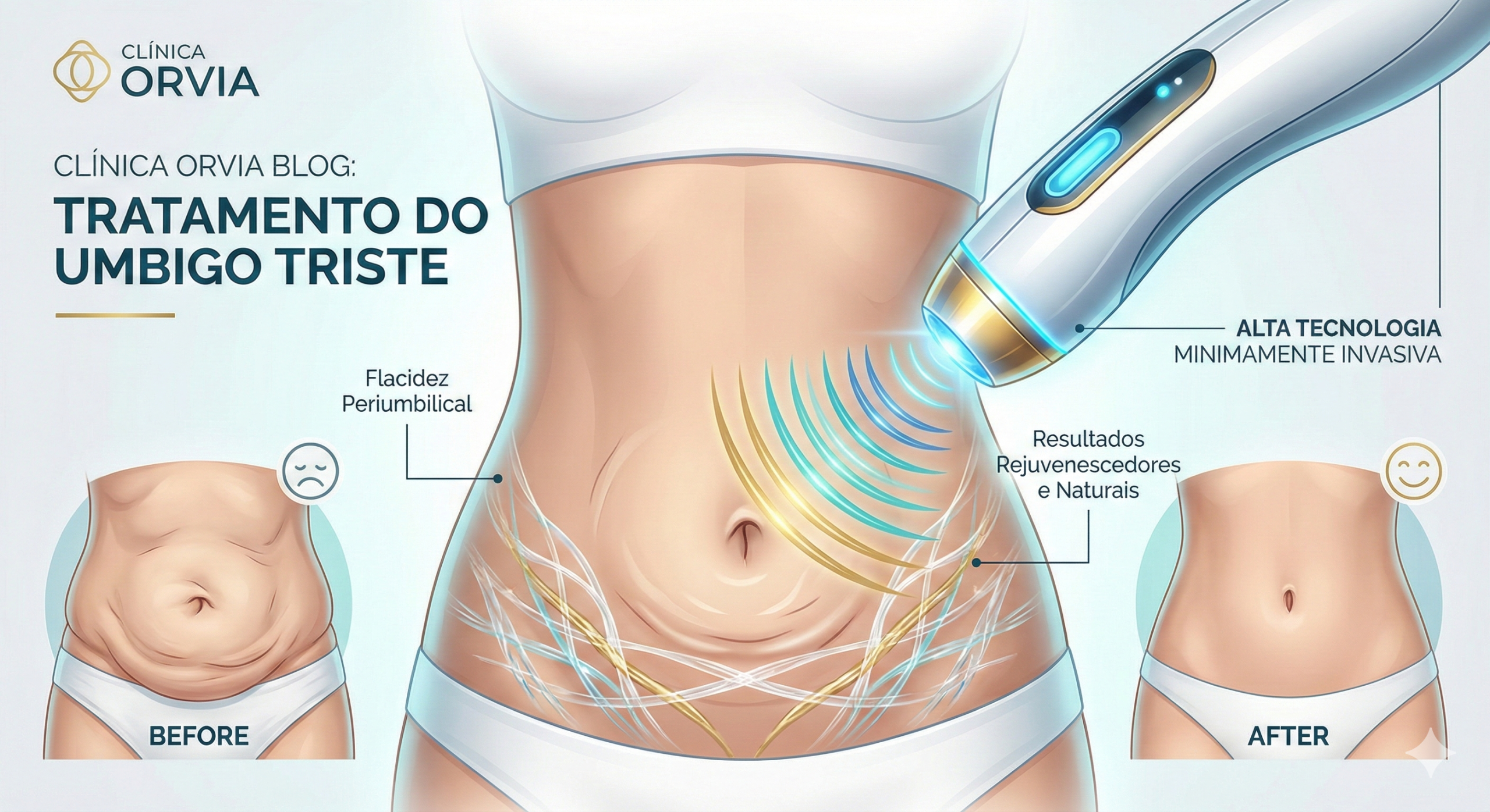 Imagem de close no abdômen mostrando o antes e depois da correção da Flacidez no Umbigo com o uso da tecnologia de retração a plasma.